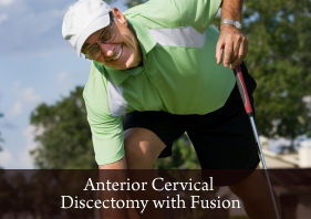 Anterior Cervical Discectomy with Fusion