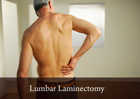 Lumbar Laminectomy